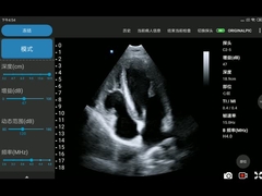 مبدل آرایه فازی پروب فراصوت بی سیم 3.6 مگاهرتز