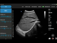دستگاه اولتراسوند بی سیم آرایه محدب الکترونیکی برای تلفن همراه