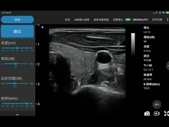 256 خطوط اسکن Ipad مبدل اولتراسوند پروب بی سیم اولتراسوند برای PICC