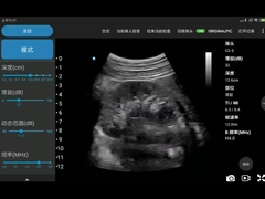 اسکنرهای اولتراسوند فای قابل حمل 3.6 مگاهرتز با علامت CE JPEG BMP PNG MPEG-4