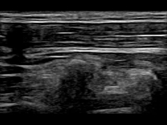 دستگاه سونوگرافی داپلر قابل حمل وای فای 12.6 سانتی متری 30 فریم بر ثانیه