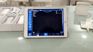 پروب اولتراسوند بی سیم دو سر برای تشخیص OB GYN