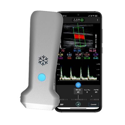 خرید اسکنر اولتراسوند رنگی داپلر خطی بی سیم WiFi | تصویربرداری بلادرنگ 30 فریم بر ثانیه | پروب سونوگرافی پزشکی قابل حمل online manufacture