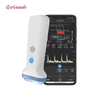 خرید اسکنر اولتراسوند نوع پروب بی سیم 12 مگاهرتز 3000 میلی آمپر ساعت برای آیفون online manufacture