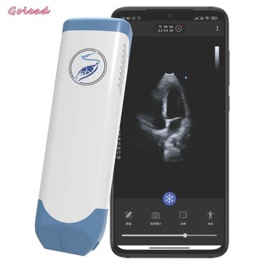 خرید مبدل آرایه فازی پروب فراصوت بی سیم 3.6 مگاهرتز online manufacture
