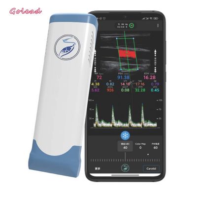خرید اسکنر اولتراسوند قابل حمل Wifi آرایه خطی الکترونیکی 12 مگاهرتز online manufacture