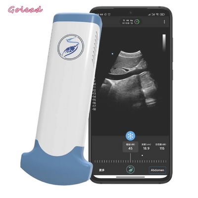 خرید دستگاه اولتراسوند بی سیم آرایه محدب الکترونیکی برای تلفن همراه online manufacture