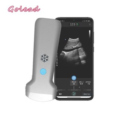 خرید سونوگرافی پروب قلب USG با آرایه محدب الکترونیکی مورد تایید CE برای اندروید online manufacture