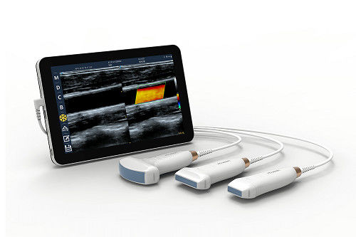 خرید اسکنر اولتراسوند دستی خطی USB Type-C پروب سونوگرافی قابل حمل 10 مگاهرتز اندروید برای عروق و POCUS online manufacture