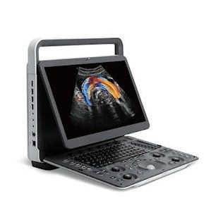 خرید دستگاه اولتراسوند قابل حمل SonoScape E2 PRO تصویربرداری پانورامیک online manufacture