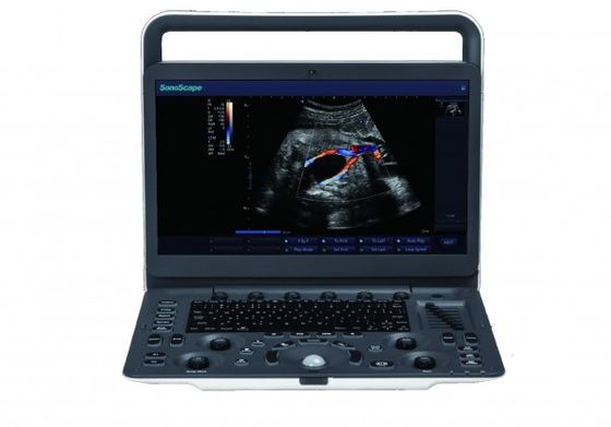 خرید دستگاه اولتراسوند قابل حمل 7 سطح تصویربرداری SonoScape E3 با مانیتور 15.6 اینچی online manufacture