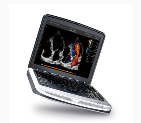 خرید دستگاه سونوگرافی لپ تاپ Chison SonoBook 8 برای اکوکاردیوگرافی مورد تایید FDA online manufacture