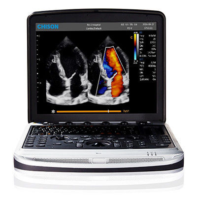خرید آسان برای حمل دستگاه سونوگرافی لپ تاپ 4D Chison SonoBook 9 online manufacture