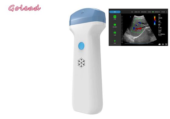 خرید کاوشگر اولتراسوند بی سیم Ipad بیهوشی برای مراقبت های اولیه POCUS Exams online manufacture