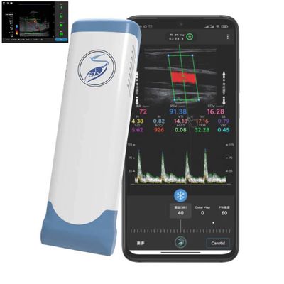 خرید 256 خطوط اسکن Ipad مبدل اولتراسوند پروب بی سیم اولتراسوند برای PICC online manufacture