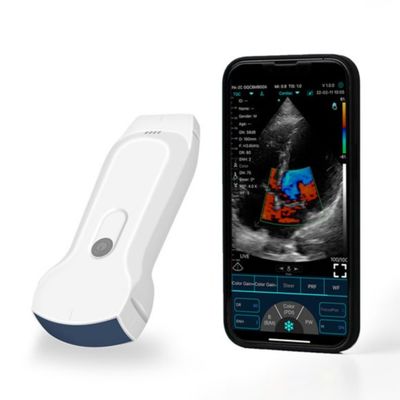 خرید اسکنر اولتراسوند دستی IPad قابل حمل POCUS برای تشخیص بالینی online manufacture