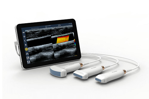 اسکنر اولتراسوند دستی خطی USB Type-C پروب سونوگرافی قابل حمل 10 مگاهرتز اندروید برای عروق و POCUS