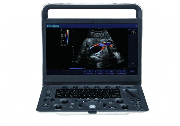 دستگاه اولتراسوند قابل حمل 7 سطح تصویربرداری SonoScape E3 با مانیتور 15.6 اینچی